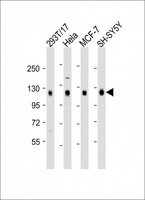 DLG1 / SAP97 Antibody - All lanes: Anti-DLG1 Antibody (Center) at 1:2000 dilution. Lane 1: 293T/17 whole cell lysate. Lane 2: HeLa whole cell lysate. Lane 3: MCF-7 whole cell lysate. Lane 4: SH-SY5Y whole cell lysate Lysates/proteins at 20 ug per lane. Secondary Goat Anti-Rabbit IgG, (H+L), Peroxidase conjugated at 1:10000 dilution. Predicted band size: 100 kDa. Blocking/Dilution buffer: 5% NFDM/TBST.