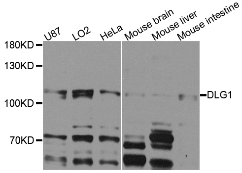 DLG1 / SAP97 Antibody - Western blot analysis of extracts of various cells.