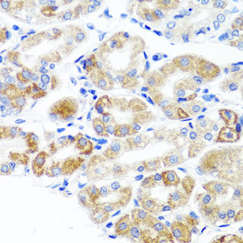 DLG1 / SAP97 Antibody - Immunohistochemistry of paraffin-embedded human stomach tissue.