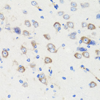 DLG1 / SAP97 Antibody - Immunohistochemistry of paraffin-embedded rat brain tissue.