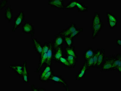 DLG1 / SAP97 Antibody - Immunofluorescent analysis of Hela cells diluted at 1:100 and Alexa Fluor 488-congugated AffiniPure Goat Anti-Rabbit IgG(H+L)