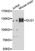 DLG1 / SAP97 Antibody - Western blot analysis of extracts of various cell lines, using DLG1 antibody at 1:1000 dilution. The secondary antibody used was an HRP Goat Anti-Rabbit IgG (H+L) at 1:10000 dilution. Lysates were loaded 25ug per lane and 3% nonfat dry milk in TBST was used for blocking. An ECL Kit was used for detection and the exposure time was 90s.