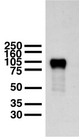 DLG2 / PSD93 Antibody - Adult rat brain membranes