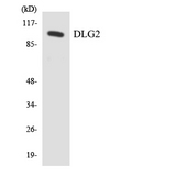 DLG2 / PSD93 Antibody - Western blot analysis of the lysates from HeLa cells using DLG2 antibody.