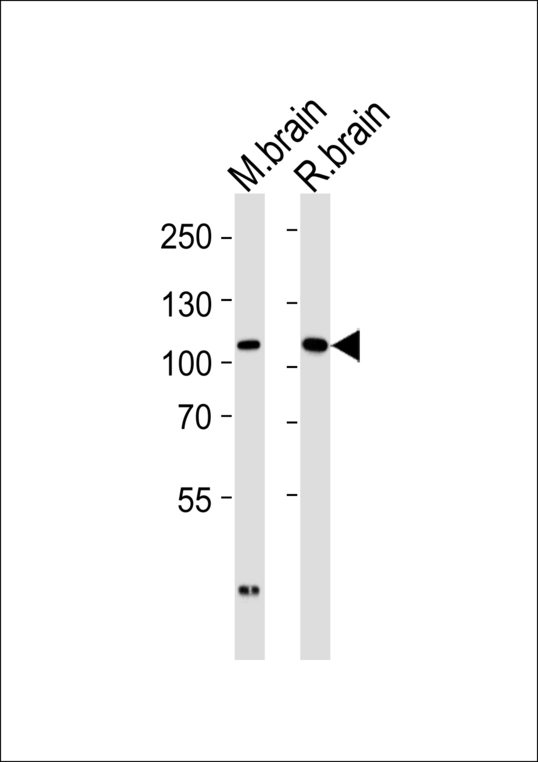 DLG2 / PSD93 Antibody - Western blot of tissue lysates from mouse brain and rat brain (from left to right) with DLG2 Antibody. Antibody was diluted at 1:1000 at each lane. A goat anti-rabbit IgG H&L (HRP) at 1:5000 dilution was used as the secondary antibody. Lysates at 35 ug per lane.