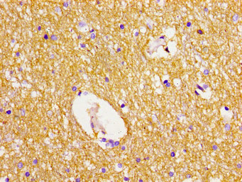 DLG2 / PSD93 Antibody - Immunohistochemistry image of paraffin-embedded human brain tissue at a dilution of 1:100