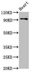 DLG2 / PSD93 Antibody - Positive Western Blot detected in Rat heart tissue. All lanes: DLG2 antibody at 2.8 µg/ml Secondary Goat polyclonal to rabbit IgG at 1/50000 dilution. Predicted band size: 98, 110, 84, 101, 39 KDa. Observed band size: 98 KDa