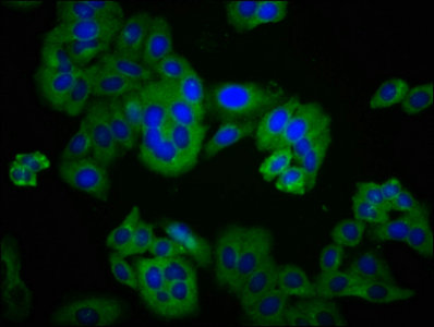 DLG2 / PSD93 Antibody - Immunofluorescence staining of HepG2 cells with DLG2 Antibody at 1:233, counter-stained with DAPI. The cells were fixed in 4% formaldehyde, permeabilized using 0.2% Triton X-100 and blocked in 10% normal Goat Serum. The cells were then incubated with the antibody overnight at 4°C. The secondary antibody was Alexa Fluor 488-congugated AffiniPure Goat Anti-Rabbit IgG(H+L).
