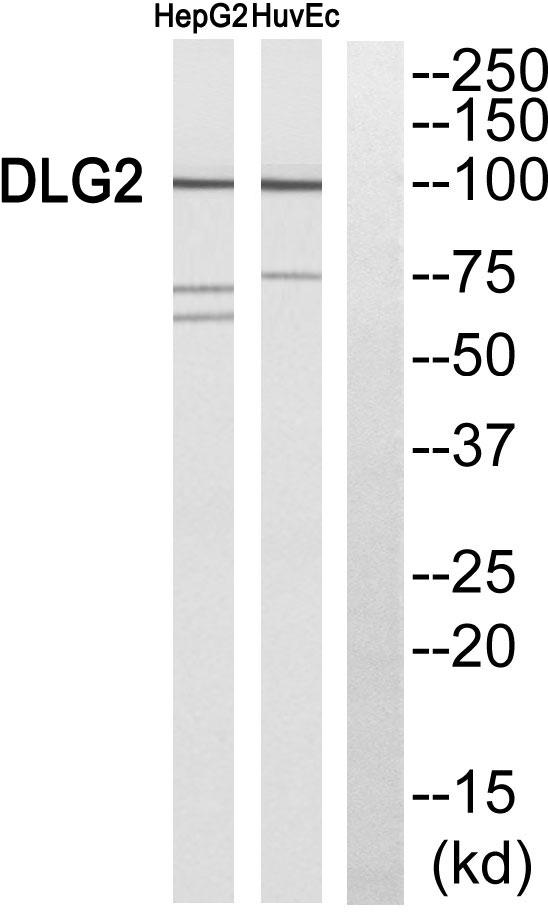 DLG2 / PSD93 Antibody - Western blot analysis of extracts from HepG2 cells and HuvEc cells, using DLG2 antibody.