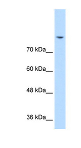 DLG2 / PSD93 Antibody - Western blot of Jurkat lysate using Anti-DLG2 Antibody.  This image was taken for the unconjugated form of this product. Other forms have not been tested.