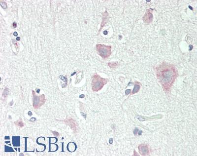 DLG2 / PSD93 Antibody - Human Brain, Cortex: Formalin-Fixed, Paraffin-Embedded (FFPE).  This image was taken for the unconjugated form of this product. Other forms have not been tested.