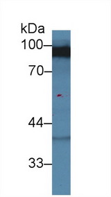 DLG3 / SAP102 Antibody - Western Blot; Sample: Rat Cerebrum lysate; Primary Ab: 2µg/ml Rabbit Anti-Human DLG3 Antibody Second Ab: 0.2µg/mL HRP-Linked Caprine Anti-Rabbit IgG Polyclonal Antibody