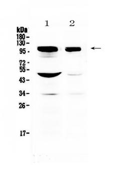 DLG3 / SAP102 Antibody - Western blot analysis of SAP102 using anti-SAP102 antibody. Electrophoresis was performed on a 5-20% SDS-PAGE gel at 70V (Stacking gel) / 90V (Resolving gel) for 2-3 hours. The sample well of each lane was loaded with 50ug of sample under reducing conditions. Lane 1: rat brain tissue lysate,Lane 2: mouse brain tissue lysate. After Electrophoresis, proteins were transferred to a Nitrocellulose membrane at 150mA for 50-90 minutes. Blocked the membrane with 5% Non-fat Milk/ TBS for 1.5 hour at RT. The membrane was incubated with rabbit anti-SAP102 antigen affinity purified polyclonal antibody at 0.5 µg/mL overnight at 4°C, then washed with TBS-0.1% Tween 3 times with 5 minutes each and probed with a goat anti-rabbit IgG-HRP secondary antibody at a dilution of 1:10000 for 1.5 hour at RT. The signal is developed using an Enhanced Chemiluminescent detection (ECL) kit with Tanon 5200 system. A specific band was detected for SAP102 at approximately 102KD. The expected band size for SAP102 is at 90KD.