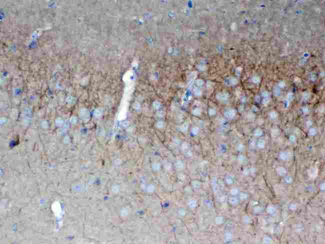 DLG3 / SAP102 Antibody - IHC analysis of SAP102 using anti-SAP102 antibody. SAP102 was detected in paraffin-embedded section of mouse brain tissue . Heat mediated antigen retrieval was performed in citrate buffer (pH6, epitope retrieval solution) for 20 mins. The tissue section was blocked with 10% goat serum. The tissue section was then incubated with 1µg/ml rabbit anti-SAP102 Antibody overnight at 4°C. Biotinylated goat anti-rabbit IgG was used as secondary antibody and incubated for 30 minutes at 37°C. The tissue section was developed using Strepavidin-Biotin-Complex (SABC) with DAB as the chromogen.