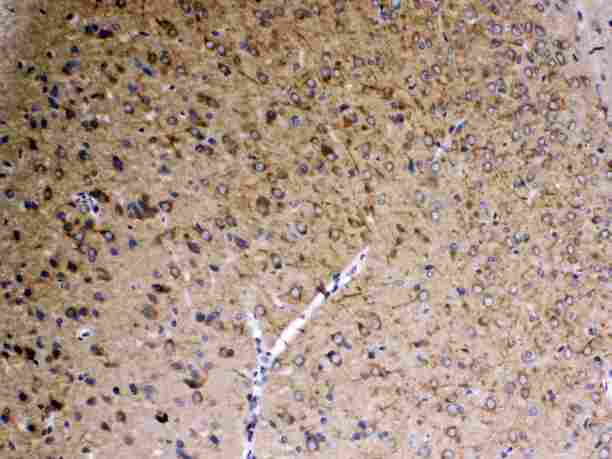 DLG3 / SAP102 Antibody - IHC analysis of SAP102 using anti-SAP102 antibody. SAP102 was detected in paraffin-embedded section of rat brain tissue . Heat mediated antigen retrieval was performed in citrate buffer (pH6, epitope retrieval solution) for 20 mins. The tissue section was blocked with 10% goat serum. The tissue section was then incubated with 1µg/ml rabbit anti-SAP102 Antibody overnight at 4°C. Biotinylated goat anti-rabbit IgG was used as secondary antibody and incubated for 30 minutes at 37°C. The tissue section was developed using Strepavidin-Biotin-Complex (SABC) with DAB as the chromogen.