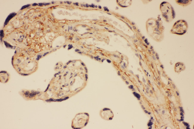 DLG4 / PSD95 Antibody - DLG4 / PSD95 antibody. IHC(P): Human Placenta Tissue.