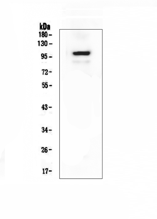 DLG4 / PSD95 Antibody - Western blot analysis of PSD95 using anti-PSD95 antibody. Electrophoresis was performed on a 5-20% SDS-PAGE gel at 70V (Stacking gel) / 90V (Resolving gel) for 2-3 hours. The sample well of each lane was loaded with 50ug of sample under reducing conditions. Lane 1: mouse brain tissue lysates. After Electrophoresis, proteins were transferred to a Nitrocellulose membrane at 150mA for 50-90 minutes. Blocked the membrane with 5% Non-fat Milk/ TBS for 1.5 hour at RT. The membrane was incubated with rabbit anti-PSD95 antigen affinity purified polyclonal antibody at 0.5 µg/mL overnight at 4°C, then washed with TBS-0.1% Tween 3 times with 5 minutes each and probed with a goat anti-rabbit IgG-HRP secondary antibody at a dilution of 1:10000 for 1.5 hour at RT. The signal is developed using an Enhanced Chemiluminescent detection (ECL) kit with Tanon 5200 system. A specific band was detected for PSD95 at approximately 100KD. The expected band size for PSD95 is at 80KD.