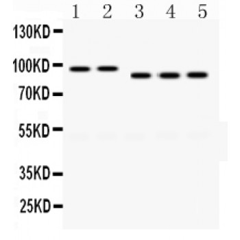 DLG4 / PSD95 Antibody - PSD95 antibody Western blot. All lanes: Anti PSD95 at 0.5 ug/ml. Lane 1: Rat Skeletal Muscle Tissue Lysate at 50 ug. Lane 2: Rat Cardiac Muscle Tissue Lysate at 50 ug. Lane 3: HELA Whole Cell Lysate at 40 ug. Lane 4: A549 Whole Cell Lysate at 40 ug. Lane 5: 293T Whole Cell Lysate at 40 ug. Predicted band size: 95 kD, 85 kD. Observed band size: 95 kD, 85 kD.