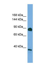 DLG4 / PSD95 Antibody - DLG4 / PSD95 antibody Western blot of HT1080 cell lysate. This image was taken for the unconjugated form of this product. Other forms have not been tested.