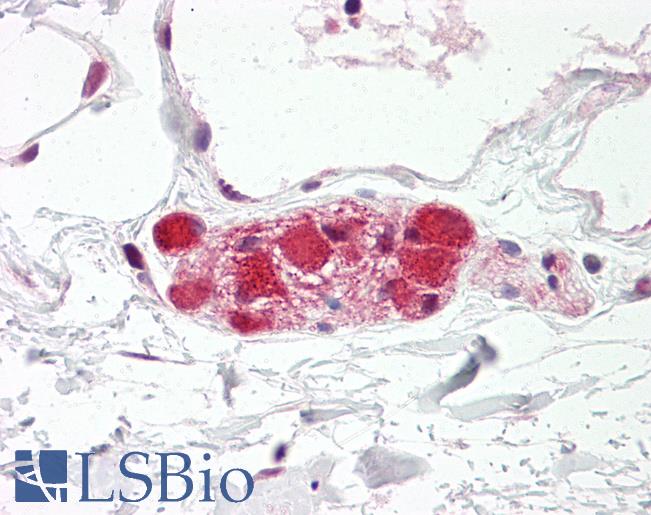 DLG4 / PSD95 Antibody - Anti-PSD95 antibody IHC of human colon, submucosal plexus. Immunohistochemistry of formalin-fixed, paraffin-embedded tissue after heat-induced antigen retrieval. Antibody dilution 2.5-5 ug/ml. This image was taken for the unconjugated form of this product. Other forms have not been tested.
