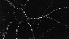 DLG4 / PSD95 Antibody - ICC of PSD95 in cultures of dissociated rat hippocampal neurons.  Fixation: Cold 4% paraformaldehyde/0.2% glutaraldehyde in 0.1M sodium phosphate buffer. Primary Antibody: Mouse Anti-PSD95 at 1:1000 for 12 hours at 4°C. Secondary Antibody: FITC Goat Anti-Mouse IgG (green) at 1:50 for 30 minutes at RT. Experiment performed with the unconjugated form of the antibody. Other forms have not been tested.