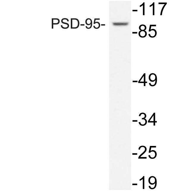 DLG4 / PSD95 Antibody - Western blot of PSD-95 (L302) pAb in extracts from COLO205 cells.