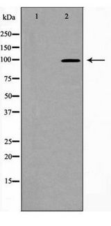 DLG4 / PSD95 Antibody - Western blot of PSD95 expression in Brain (Rat) Tissue Lysate