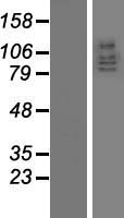 DLG5 Protein - Western validation with an anti-DDK antibody * L: Control HEK293 lysate R: Over-expression lysate