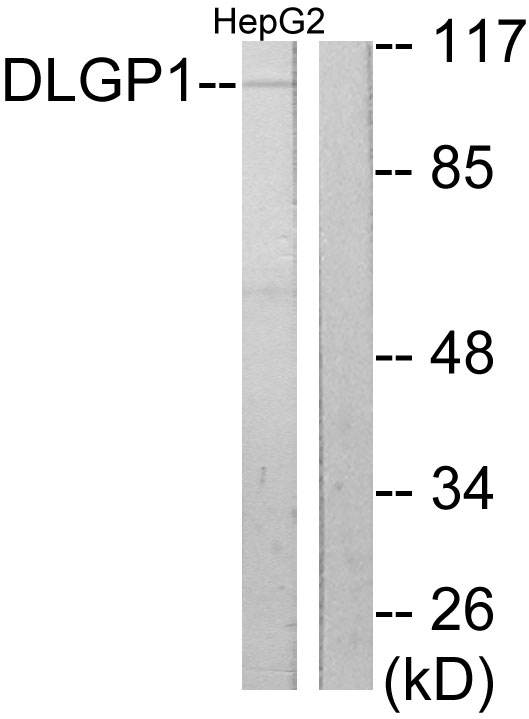 DLGAP1 Antibody - Western blot analysis of lysates from HepG2 cells, using DLGP1 Antibody. The lane on the right is blocked with the synthesized peptide.