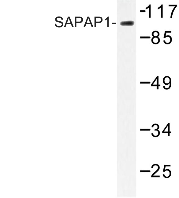 DLGAP1 Antibody - Western blot of SAPAP1 (E817) pAb in extracts from HepG2 cells.
