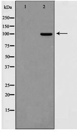 DLGAP1 Antibody - Western blot of HepG2 cell lysate using DLGP1 Antibody