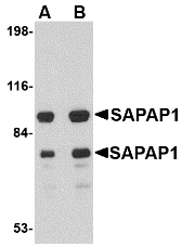 DLGAP1 Antibody - Western blot of SAPAP1 in rat brain tissue lysate with SAPAP1 antibody at (A) 0.5 and (B) 1 ug/ml.