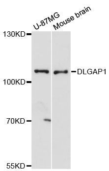DLGAP1 Antibody - Western blot analysis of extracts of various cell lines, using DLGAP1 antibody at 1:3000 dilution. The secondary antibody used was an HRP Goat Anti-Rabbit IgG (H+L) at 1:10000 dilution. Lysates were loaded 25ug per lane and 3% nonfat dry milk in TBST was used for blocking. An ECL Kit was used for detection and the exposure time was 90s.