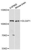 DLGAP1 Antibody - Western blot analysis of extracts of various cell lines, using DLGAP1 antibody at 1:3000 dilution. The secondary antibody used was an HRP Goat Anti-Rabbit IgG (H+L) at 1:10000 dilution. Lysates were loaded 25ug per lane and 3% nonfat dry milk in TBST was used for blocking. An ECL Kit was used for detection and the exposure time was 90s.