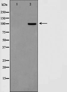 DLGAP1 Antibody - Western blot analysis on HepG2 cell lysates using DLGP1 antibody. The lane on the left is treated with the antigen-specific peptide.