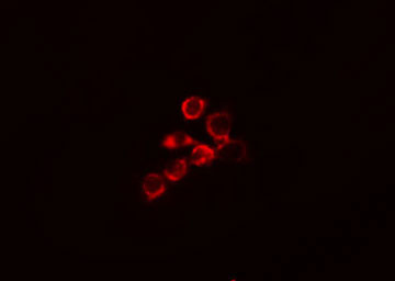 DLGAP1 Antibody - Staining MCF-7 cells by IF/ICC. The samples were fixed with PFA and permeabilized in 0.1% Triton X-100, then blocked in 10% serum for 45 min at 25°C. The primary antibody was diluted at 1:200 and incubated with the sample for 1 hour at 37°C. An Alexa Fluor 594 conjugated goat anti-rabbit IgG (H+L) antibody, diluted at 1/600, was used as secondary antibody.