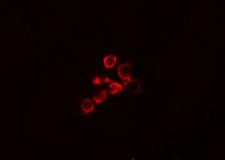 DLGAP1 Antibody - Staining MCF-7 cells by IF/ICC. The samples were fixed with PFA and permeabilized in 0.1% Triton X-100, then blocked in 10% serum for 45 min at 25°C. The primary antibody was diluted at 1:200 and incubated with the sample for 1 hour at 37°C. An Alexa Fluor 594 conjugated goat anti-rabbit IgG (H+L) antibody, diluted at 1/600, was used as secondary antibody.