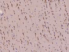 DLGAP1 Antibody - Immunochemical staining of human DLGAP1 in human brain with rabbit polyclonal antibody at 1:100 dilution, formalin-fixed paraffin embedded sections.