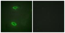 DLGAP1 Antibody - Peptide - + Immunofluorescence analysis of HeLa cells, using DLGP1 antibody.