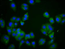 DLGAP2 Antibody - Immunofluorescence staining of HepG2 cells diluted at 1:166, counter-stained with DAPI. The cells were fixed in 4% formaldehyde, permeabilized using 0.2% Triton X-100 and blocked in 10% normal Goat Serum. The cells were then incubated with the antibody overnight at 4°C.The Secondary antibody was Alexa Fluor 488-congugated AffiniPure Goat Anti-Rabbit IgG (H+L).