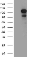 DLGAP3 / SAPAP3 Antibody - HEK293T cells were transfected with the pCMV6-ENTRY control. (Left lane) or pCMV6-ENTRY DLGAP3. (Right lane) cDNA for 48 hrs and lysed