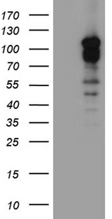DLGAP3 / SAPAP3 Antibody - HEK293T cells were transfected with the pCMV6-ENTRY control. (Left lane) or pCMV6-ENTRY DLGAP3. (Right lane) cDNA for 48 hrs and lysed. Equivalent amounts of cell lysates. (5 ug per lane) were separated by SDS-PAGE and immunoblotted with anti-DLGAP3. (1:500)