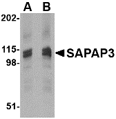 DLGAP3 / SAPAP3 Antibody - Western blot of SAPAP3 in rat brain tissue lysate with SAPAP3 antibody at (A) 1 (B) 2 ug/ml.