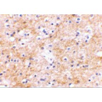 DLGAP3 / SAPAP3 Antibody - Immunohistochemical staining of human brain tissue using SAPAP3 antibody at 2.5 µg/mL.
