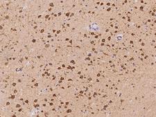 DLGAP3 / SAPAP3 Antibody - Immunochemical staining of human DLGAP3 in human brain with rabbit polyclonal antibody at 1:100 dilution, formalin-fixed paraffin embedded sections.
