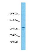 DLGAP3 / SAPAP3 Antibody - Western blot of DLGAP3 Antibody with human 721_B Whole Cell lysate.  This image was taken for the unconjugated form of this product. Other forms have not been tested.