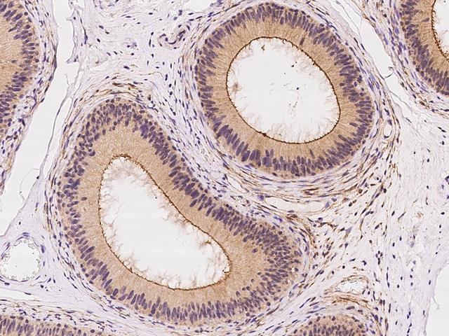 DLGAP4 Antibody - Immunochemical staining of human DLGAP4 in human epididymis with rabbit polyclonal antibody at 1:100 dilution, formalin-fixed paraffin embedded sections.