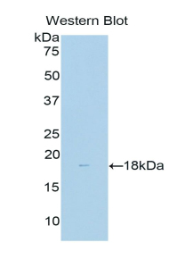 DLK1 / Pref-1 Antibody - Western blot of recombinant DLK1 / Pref-1.  This image was taken for the unconjugated form of this product. Other forms have not been tested.