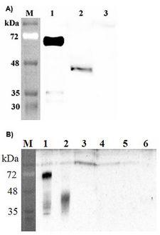 DLK1 / Pref-1 Antibody - Western blot analysis of human DLK1 using anti-DLK1 (human), pAb at 1: 2,000 dilution. A. 1. Human DLK1 (Fc protein). 2. Transfected human DLK1 full length cell lysate (HEK 293). 3. Mock Transfected HEK293 cell lysate. B. 1. Human DLK-1 (Fc protein), 200ng. 2. Human DLK-1(ecd) (FLAG-tagged), 200ng. 4. Mouse Vaspin (Fc protein) (control), 200ng. 5. Human Klotho (Fc protein) (control), 200ng. 6. Human Jagged1 (Fc protein) (control), 200ng.