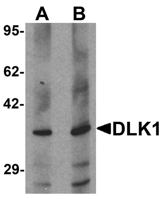 DLK1 / Pref-1 Antibody - Western blot analysis of HepG2 in 293 cell lysate with DLK1 antibody at (A) 1 and (B) 2 ug/ml.